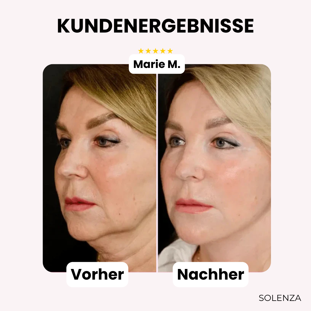 Letzter Tag -50%🔥 | GlowLift™ Unsichtbares Gesichtslifting-Band (40 Stück)