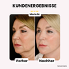 Letzter Tag -50%🔥 | GlowLift™ Unsichtbares Gesichtslifting-Band (40 Stück)