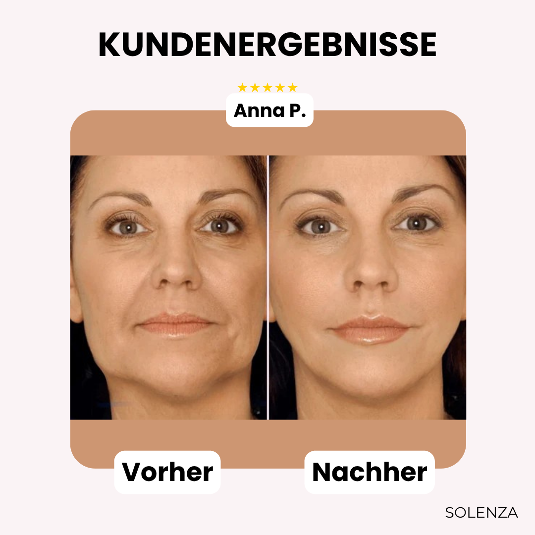 Letzter Tag -50%🔥 | GlowLift™ Unsichtbares Gesichtslifting-Band (40 Stück)