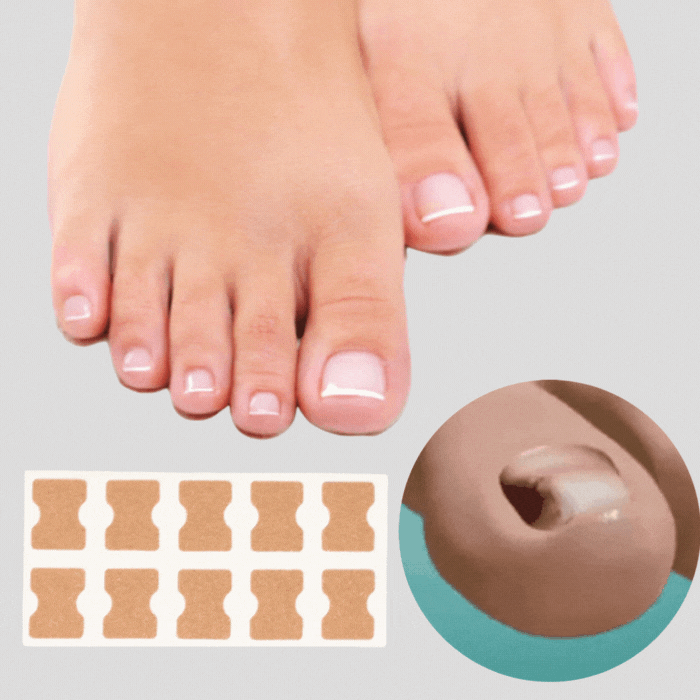 Letzter Tag -50% | PediPatch™ Nagelkorrigierende Pflaster (100 Stück)