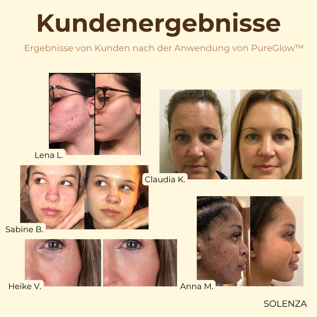 1+1 GRATIS | PureGlow™ Schwarztee-Gesichtsmaske
