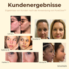 1+1 GRATIS | PureGlow™ Schwarztee-Gesichtsmaske