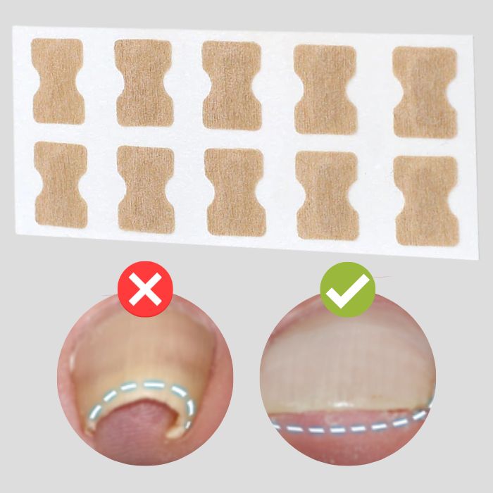 Letzter Tag -50% | PediPatch™ Nagelkorrigierende Pflaster (100 Stück)