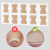 Letzter Tag -50% | PediPatch™ Nagelkorrigierende Pflaster (100 Stück)
