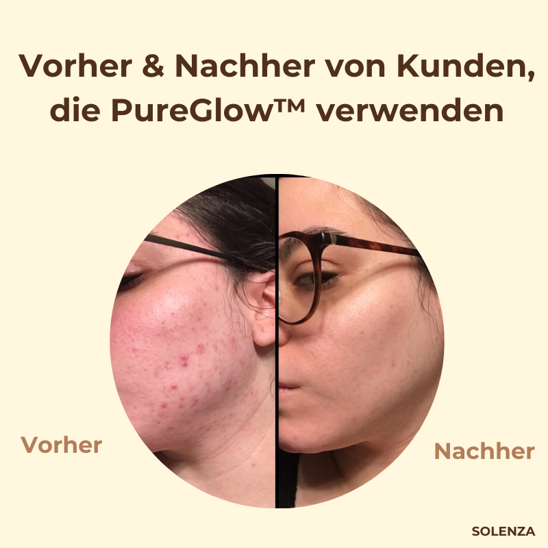 50% RABATT I PureGlow™ Schwarztee-Maske